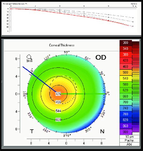 instrument measure thickness of cornea|normal corneal thickness chart.